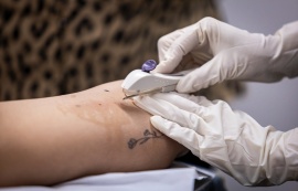 Gestão JHC marca avanço histórico na saúde da mulher com inserção gratuita do Implanon