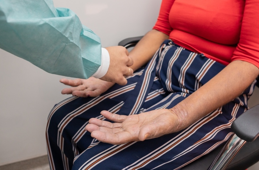 Saúde realiza Dia H de conscientização, prevenção e combater à hanseníase