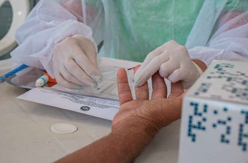 Saúde reforça importância da testagem do HIV
