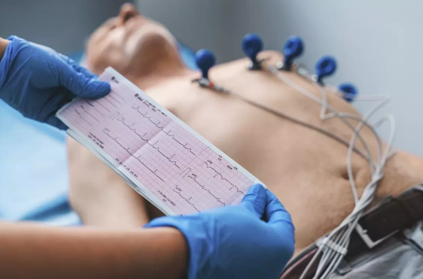 Unidades de Referência realizaram desde maio de 2023 mais de 4.500 eletrocardiogramas
